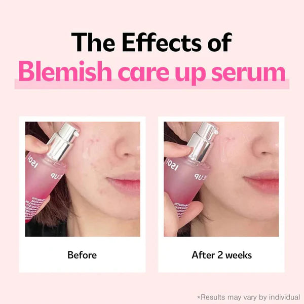 ISOI -  Blemish Care Up Serum